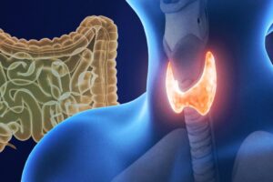 slow-thyroid-check-your-gut-first-5884868