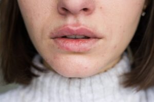 labios-quemados-portada-scaled-e1766212177879
