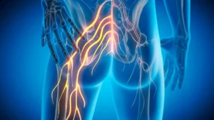curing-sciatica-without-powerful-drugs-curing-sciatica-without-powerful-drugs-2-FC2-B50-B3-F1-EFE433947-B3